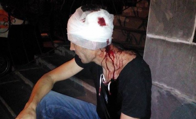 В Ирпене сильно избили активиста, выступающего против уничтожения зеленых зон города