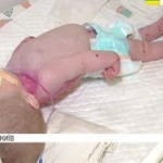 В киевской клинике врачи чуть не довели до смерти годовалого ребенка (видео)