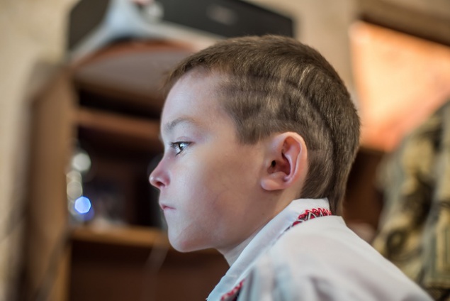 Четырнадцатилетнему Рустаму Тимошенко требуется помощь на лечение редкой генетической болезни кожи