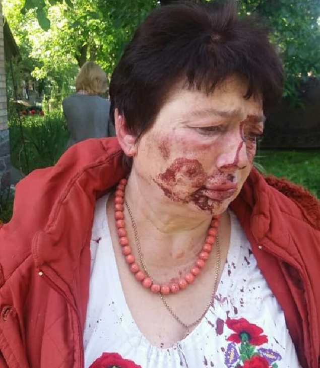 В Коцюбинском избили главу теризбиркома (фото)