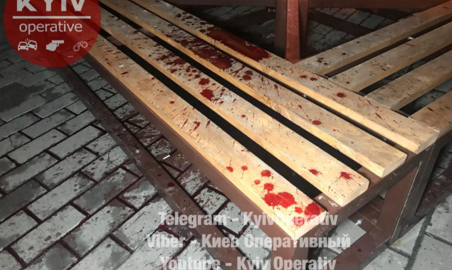 В Киеве облили кровью ханукальный светильник (фото, видео)
