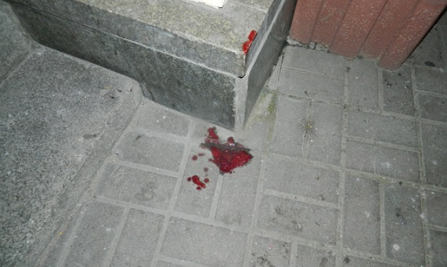 Прохожего в центре Киева избили и ограбили несовершеннолетние разбойники