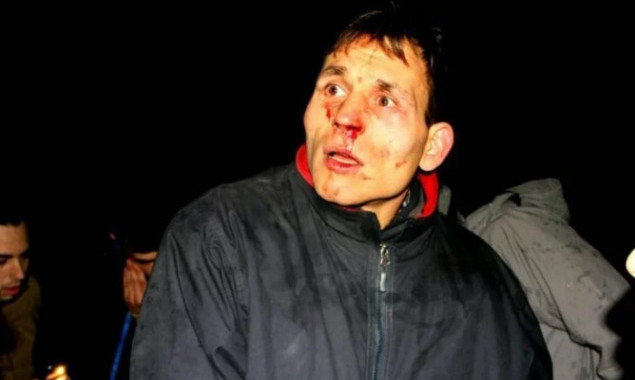 Депутат Новиков требует от прокуратуры объективного расследования избиения его сотрудниками полиции
