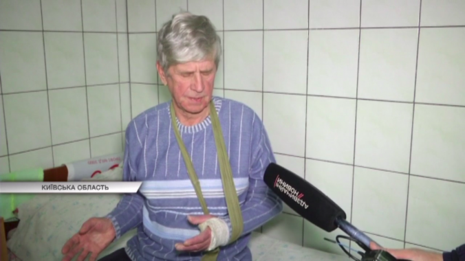 Сотрудники “Киевоблэнерго” сломали руку пенсионеру в Броварах якобы за воровство электроэнергии