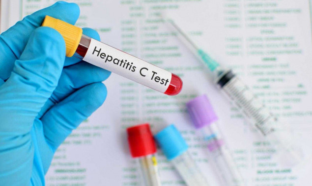 Завтра, 26 июля, киевляне смогут бесплатно пройти экспресс-тестирование на вирусный гепатит