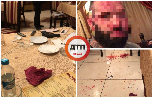 Группа мужчин восточной внешности серьезно ранила посетителя ресторана в центре Киева