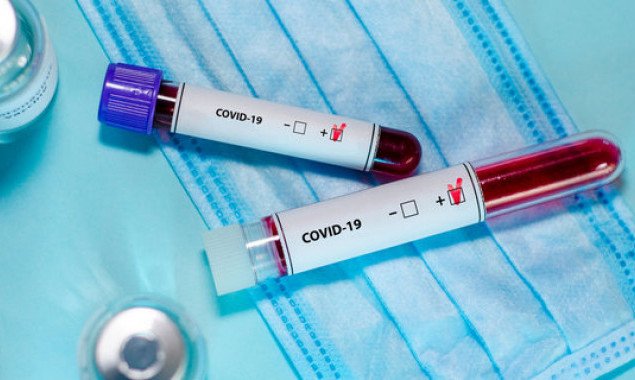 В Киеве зафиксировали уже 74 случая заболевания коронавирусом