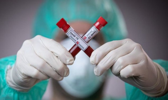 В Киеве и Киевской области за сутки выявили еще 65 зараженных коронавирусом