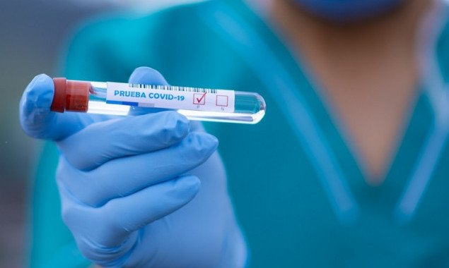 На Киевщине за сутки зафиксировано 40 новых случаев коронавирусной болезни