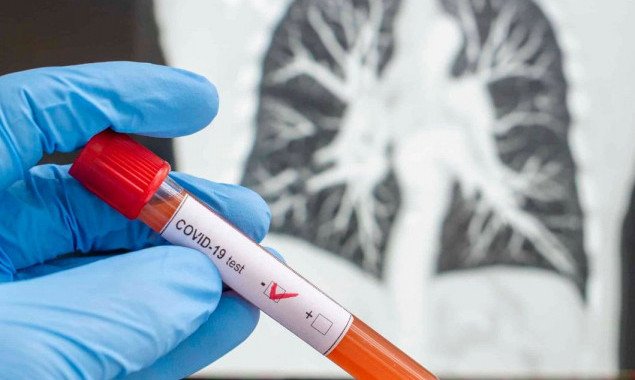 В Украине снова зафиксирован рекорд по количеству выявленных за сутки новых носителей коронавируса