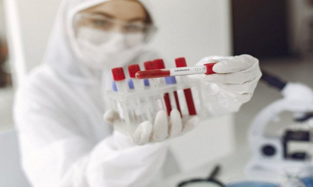 Знов антирекорд: за добу на коронавірус захворіли 774 мешканці Київщини