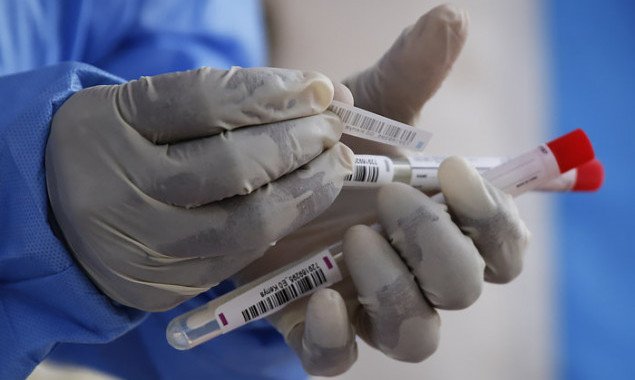 В Украине за сутки выявлено более 13 тысяч новых носителей коронавируса