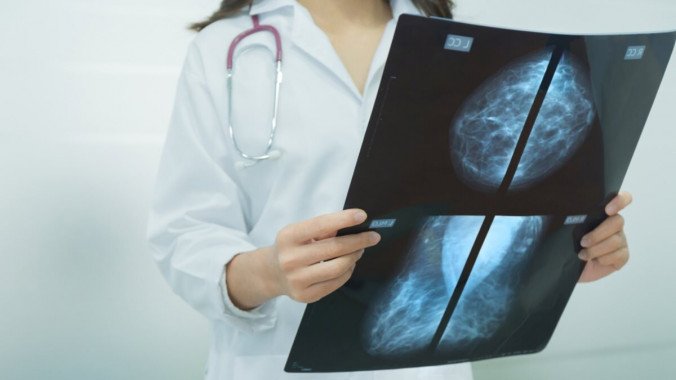 Медикам поручили наладить в Киеве систему мамографического скрининга