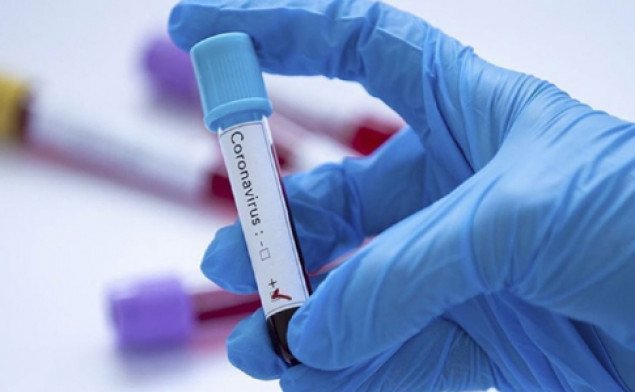 За сутки в Украине выявили почти 16 тысяч новых носителей коронавируса