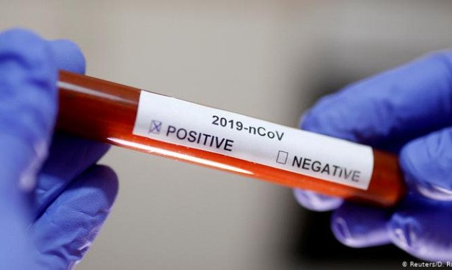 За сутки в Украине выявили более 12 тысяч новых носителей коронавируса