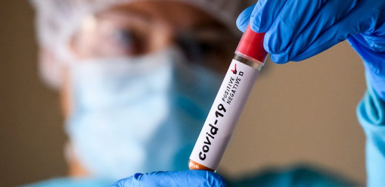За сутки в Украине выявили 8 710 новых случаев коронавируса