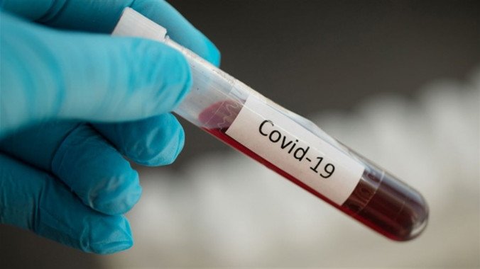 За сутки в Украине выявили 1045 носителей коронавируса