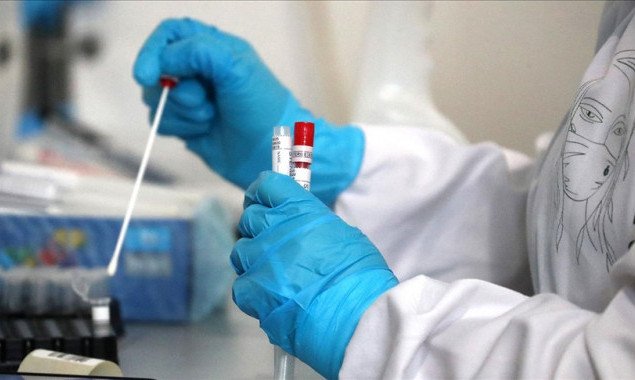 За прошедшие сутки в Украине выявили менее 900 носителей коронавируса