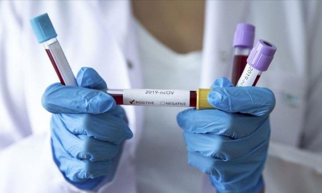 За добу на коронавірус захворіли 50 жителів Київщини