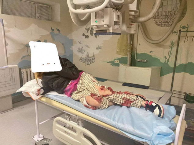 Ракетний обстріл біля дитячої лікарні Охматдит – прокуратурою розпочато розслідування