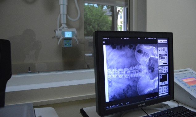 Ірпінська міська лікарня спрямовує майже 6 млн гривень на рентгенологічну систему