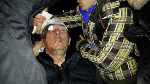 Бывшему министру МВД Луценко разбили голову