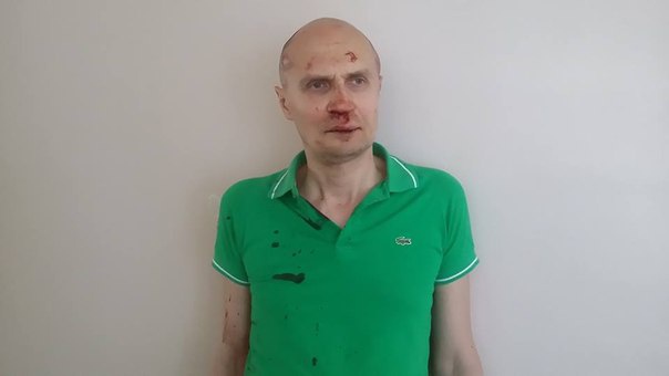 В Киеве избит общественный активист Виталий Черняховский