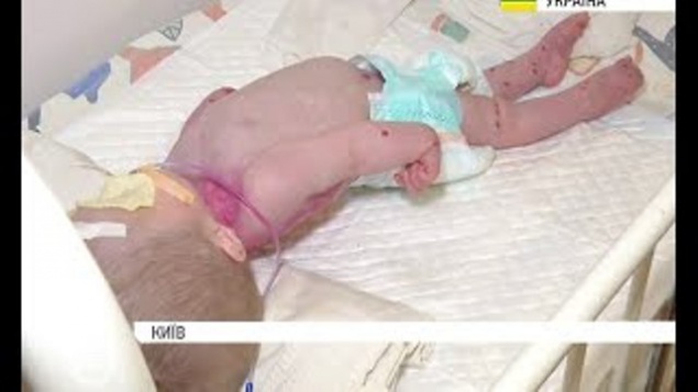 В киевской клинике врачи чуть не довели до смерти годовалого ребенка (видео)