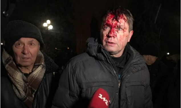 В Киеве полиция пыталась штурмовать палаточный городок сторонников Саакашвили (фото, видео)