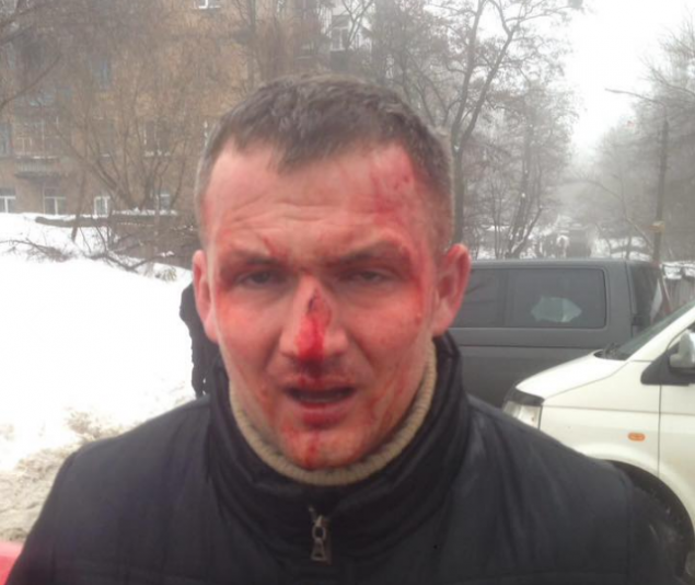 Нардепа Юрия Левченко в Киеве избили до потери сознания (фото)