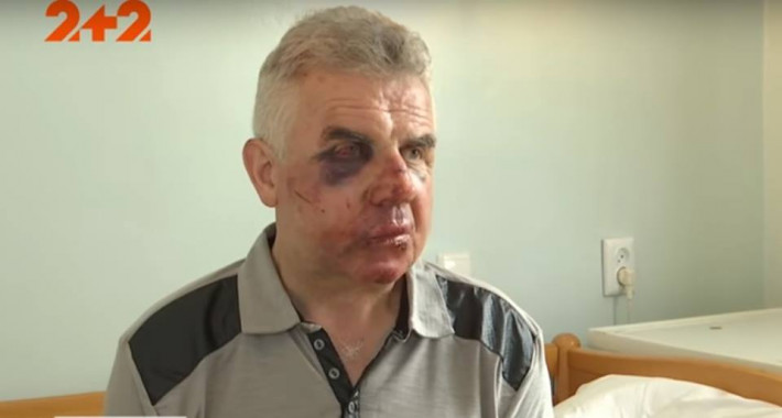 Неизвестные напали на семью головы Пуховского сельсовета (видео)
