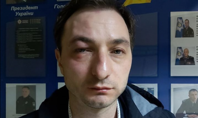 В Киеве неизвестные напали на главного врача Национального института рака (фото, видео)