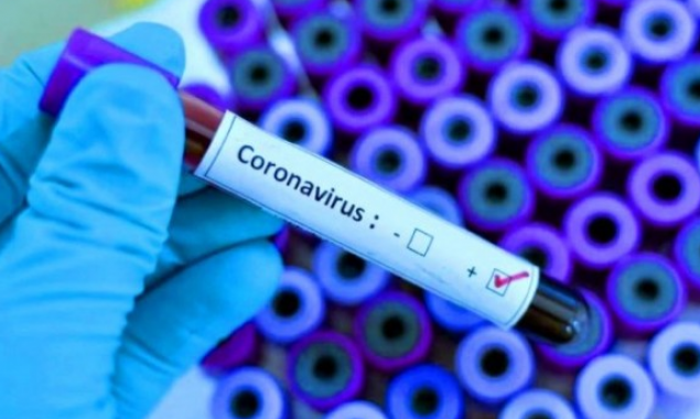КГГА накупила лекарств для лечения больных коронавирусом почти на 102 млн гривен