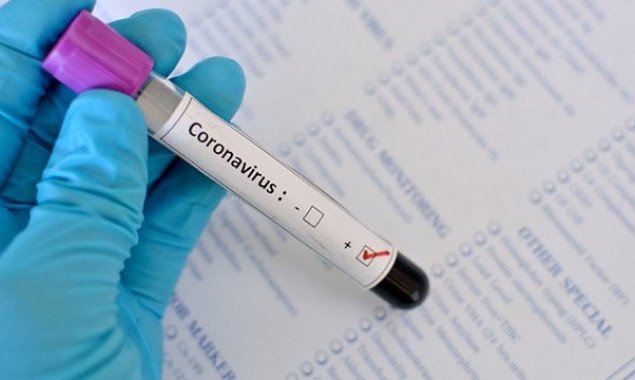 Большинство киевлян, у которых диагноз COVID-19 подтвердился за минувшие сутки, заразились внутри страны