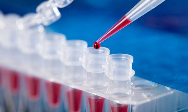 Гослекслужба проводит проверку киевской лаборатории из-за проблем с ПЦР-тестами на коронавирус