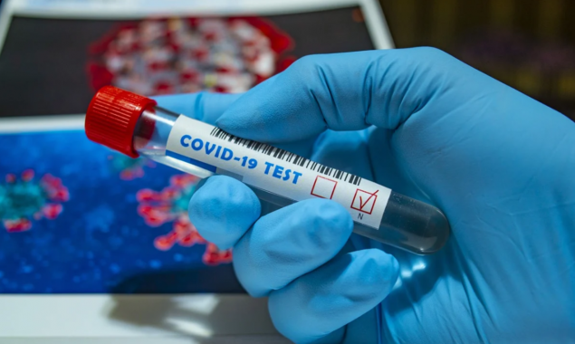 За сутки в Украине зафиксировано более 400 новых случаев заболевания COVID-19