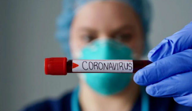 В Броварском районе в пансионате для престарелых людей зарегистрировали вспышку коронавируса