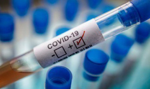 За сутки в Украине подтверждено 550 новых случаев заболевания COVID-19