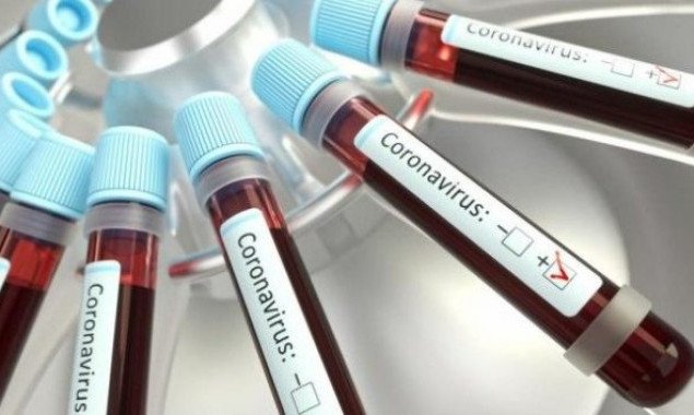 В Украине за сутки зафиксировано почти 500 новых случаев заболевания COVID-19