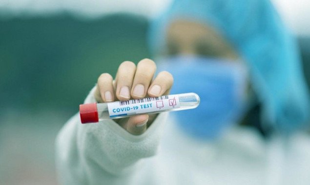 За сутки в Украине выздоровело от коронавирусной болезни больше людей, чем заболели