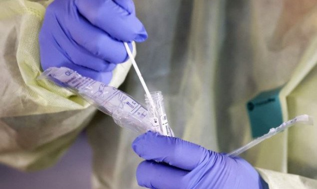 За добу на Київщині виявили 78 нових носіїв коронавірусу