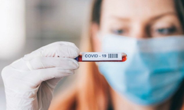 В Киеве зафиксировано наибольшее количество смертей от коронавируса за сутки