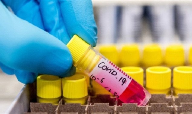За сутки в Украине зафиксировано 3240 новых носителей коронавируса