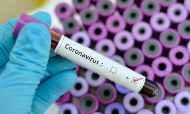 За добу на Київщині був виявлений 141 носій коронавірусу