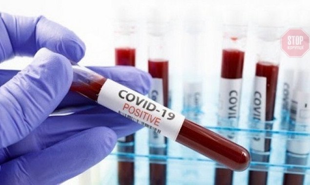 За добу на коронавірус захворіли 670 мешканців Київщини