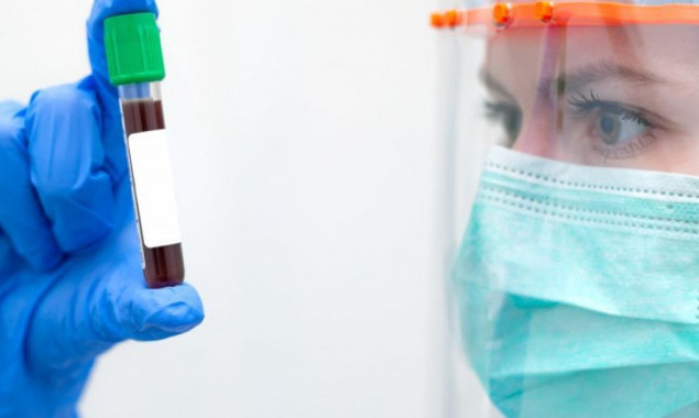 За прошедшие сутки в Украине провели немногим более 15 тысяч тестов на коронавирус