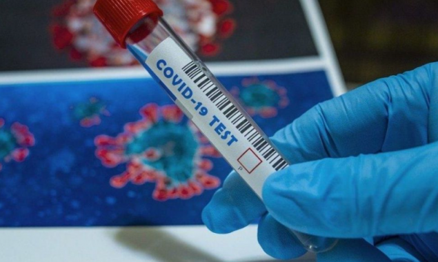 За минулу добу в 242 жителів Київщини виявили захворювання на коронавірус