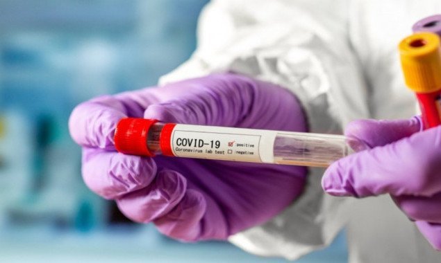 Почти 8 тысяч носителей коронавируса выявили за сутки в Украине