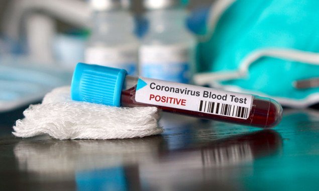 В Киеве за сутки зафиксировали около 500 новых носителей коронавируса