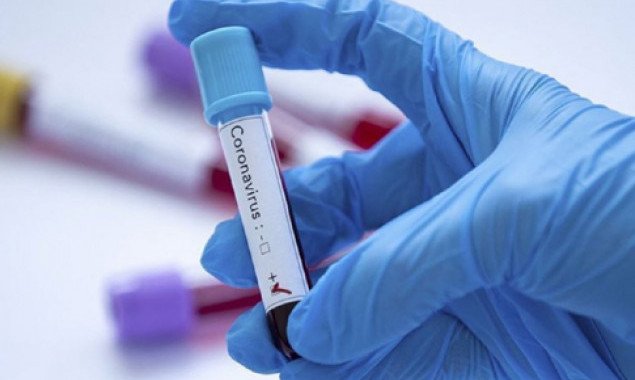 В Украине зафиксировано более 9 тысяч новых носителей коронавирусной болезни